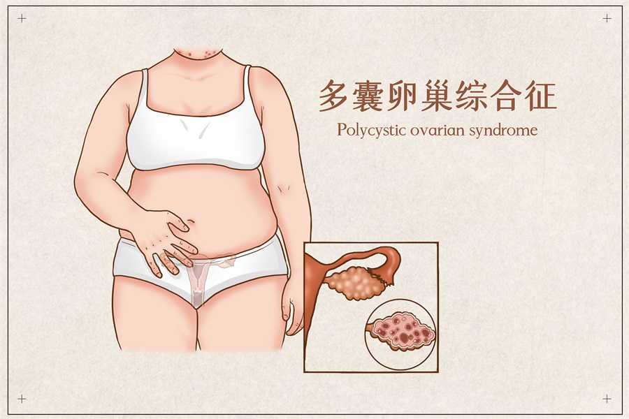 代孕公司包男孩，无排卵怎么治疗方法有哪些