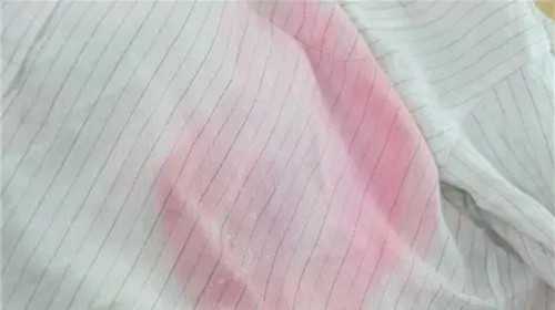 代孕公司的费用孩子发育迟缓应对症治疗